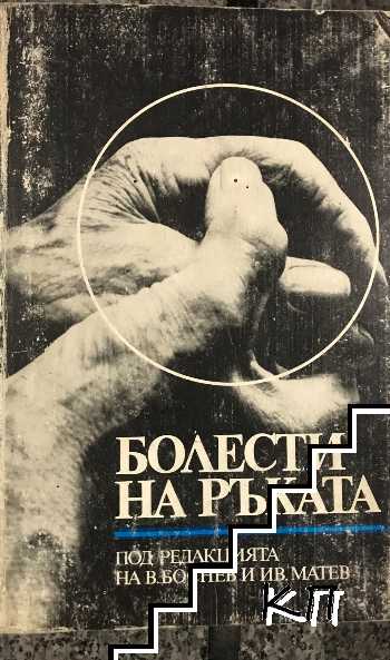 Болести на ръката