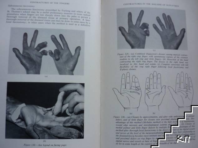 The Hand (Допълнителна снимка 3)