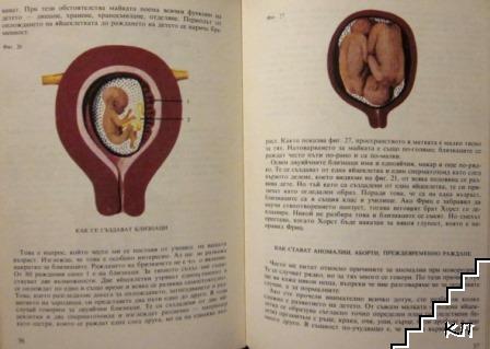Преди да се роди детето (Допълнителна снимка 2)