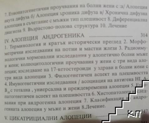 Алопеции (Допълнителна снимка 3)