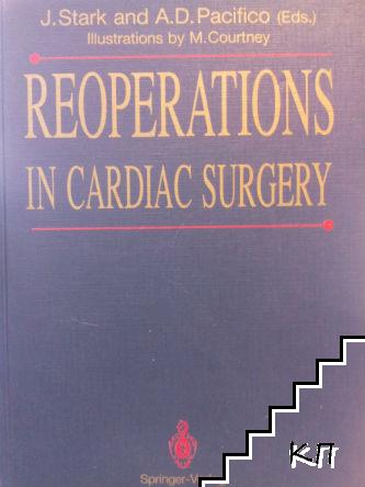 Reoperations in Cardiac Surgery