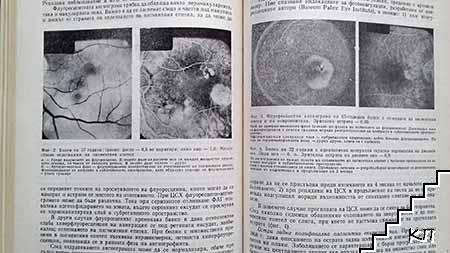 Актуални проблеми на офталмологията (Допълнителна снимка 3)