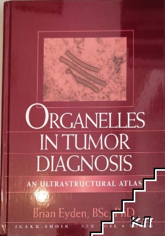 Organelles in tumor diagnosis