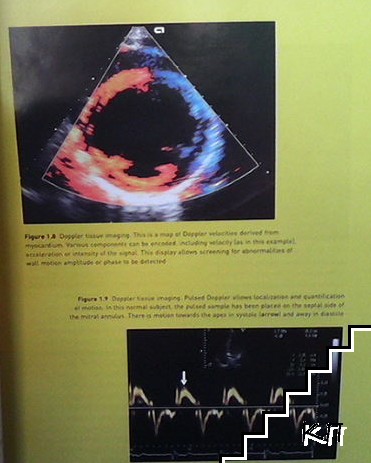 Echocardiography in clinical practice (Допълнителна снимка 3)