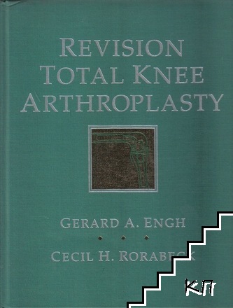 Revision Total Knee Arthroplasty