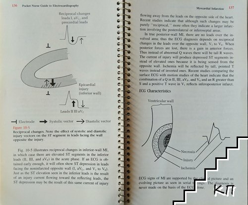 Pocket Guide to Electrocardiography (Допълнителна снимка 2)