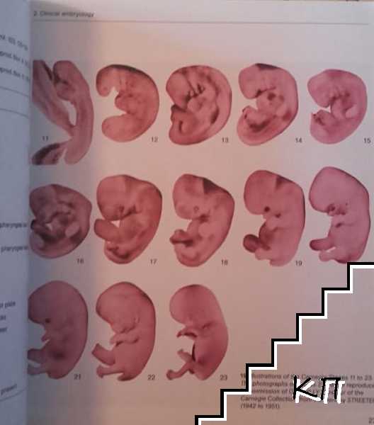Early Pregnancy (Допълнителна снимка 1)