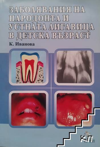 Заболявания на пародонта и устната лигавица в детската възраст