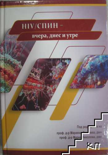 Hiv/Спин - вчера, днес и утре