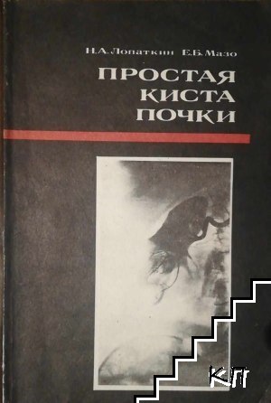Простая киста почки