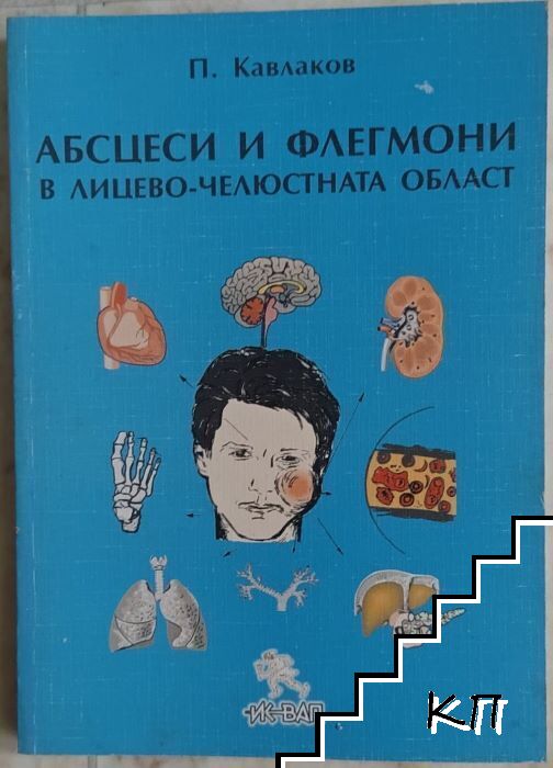 Абсцеси и флегмони в лицево-челюстната област