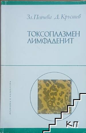 Токсоплазмен лимфаденит