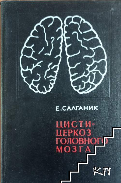 Цистицеркоз головного мозга