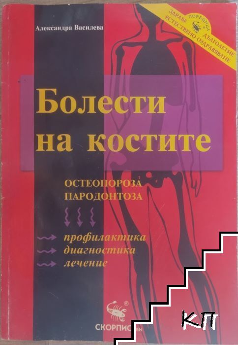 Болести на костите Болести на костите