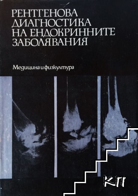 Рентгенова диагностика на ендокринните заболявания