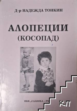 Алопеции