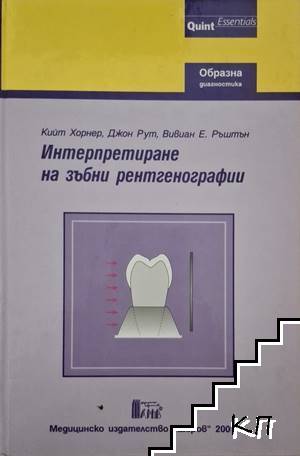 Интерпретиране на зъбни рентгенографии