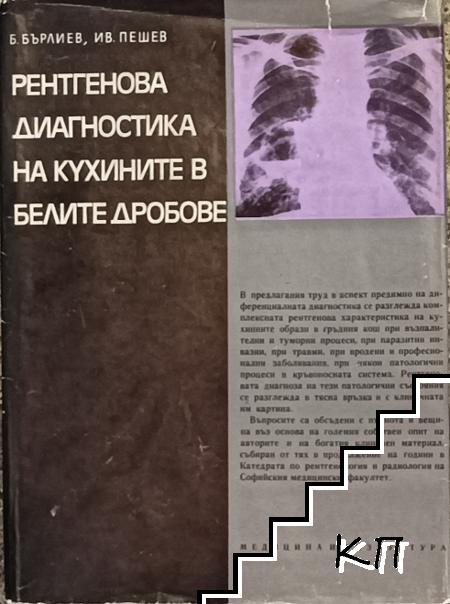 Рентгенова диагностика на кухините в белите дробове