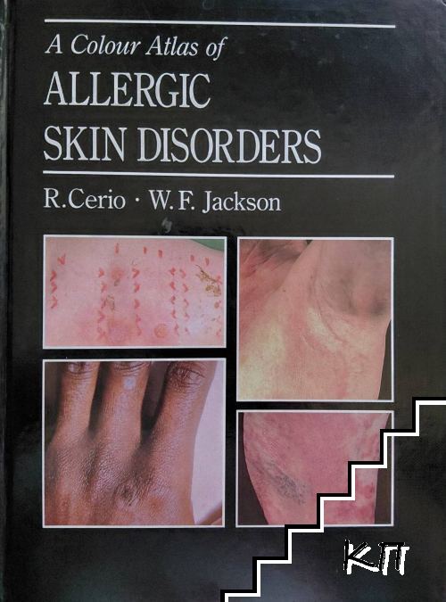 A Colour Atlas of Allergic Skin Disorders