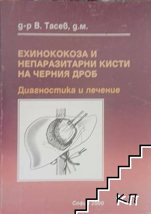 Ехинококоза и непаразитни кисти на черния дроб