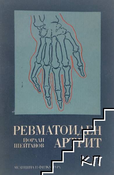 Ревматоиден артрит Ревматоиден артрит