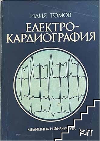 Електрокардиография