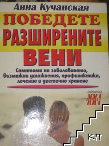Победете разширените вени