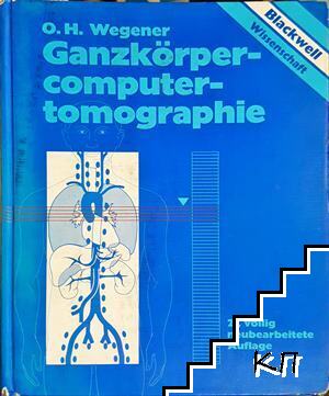 Ganzkörper-computertomographie (2., völlig neubearbeitete Auflage) Ganzkörper-computertomographie (2., völlig neubearbeitete Auflage)