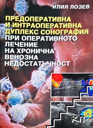 Предоперативна и интраоперативна дуплекс сонография при оперативното лечение на хронична венозна недостатъчност Предоперативна и интраоперативна дуплекс сонография при оперативното лечение на хронична венозна недостатъчност
