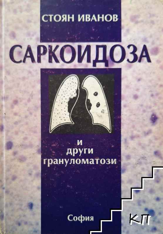Саркоидоза и други грануломатози