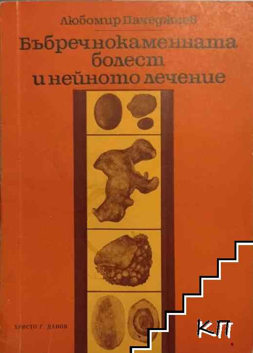 Бъбречнокаменната болест и нейното лечение