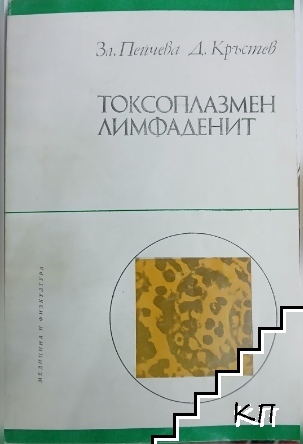 Токсоплазмен лимфаденит