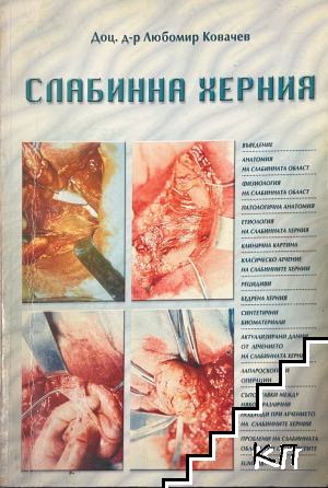 Слабинна херния